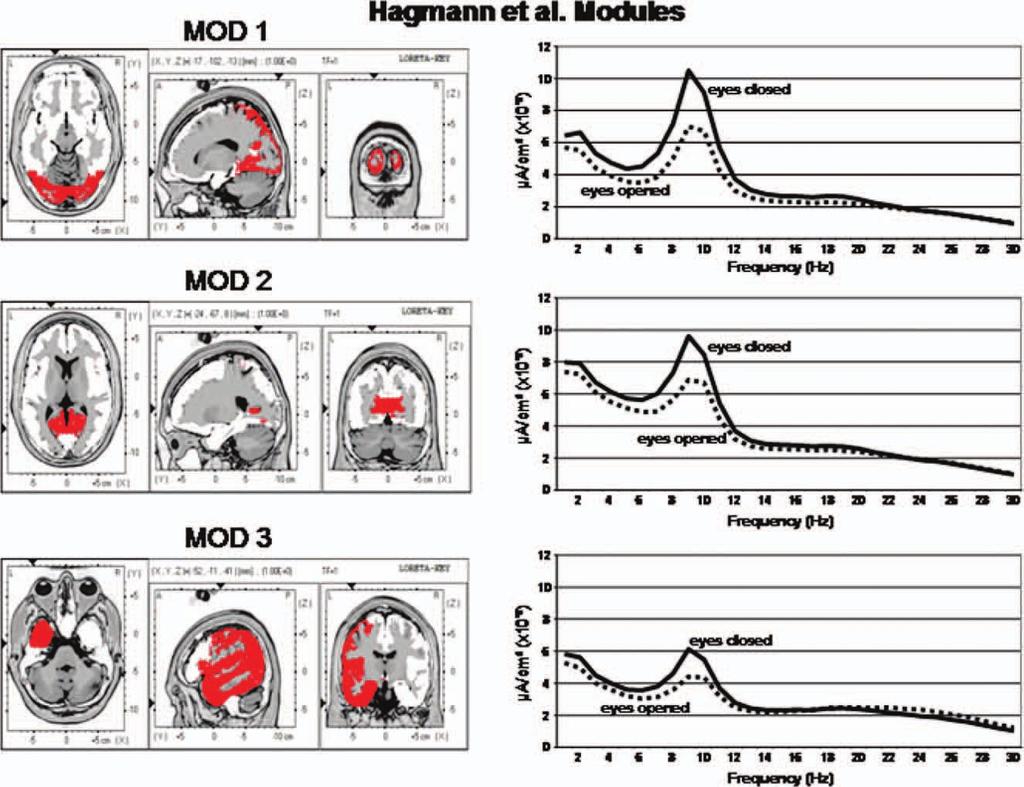 r EEG and Diffusion Spectral Imaging Modules r Left are the voxel locations of the Hagmann et al. [2008] Modules 1 to 3 as shown in Figure 1.