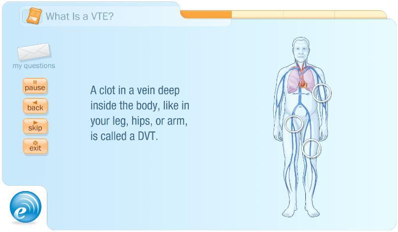 UNDERSTANDING YOUR HEALTH JUST GOT EASIER To help you understand more about VTEs (which are basically blood clots), and feel more comfortable about your health, we invite you to view this brief Emmi