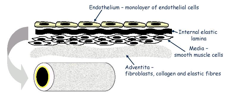 Atherosclerosis the process Starts with endothelial injury This damage allows adhesion and aggregation of platelets leading to
