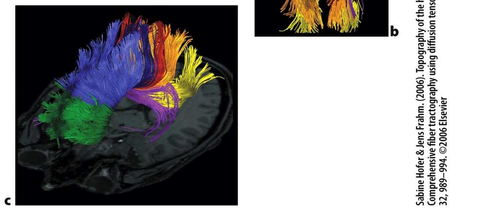 motor cortex (dark blue), primary somatosensory cortex (red),