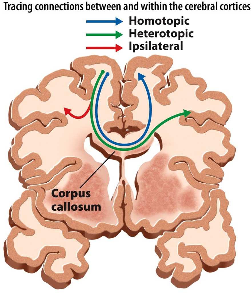 The caudal surface of a coronal section of brain roughly through the premotor cortical area.
