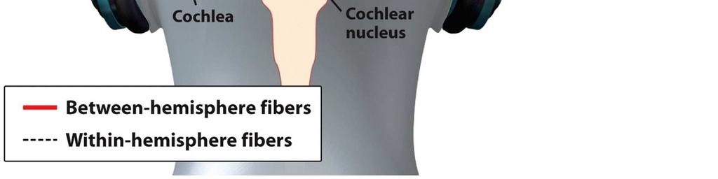 the cochlear nucleus project to the