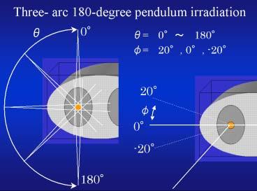 Figure 2 Geometrical conditions for simulation three-arc 180-degree pendulum irradiation. Caption of Fig.