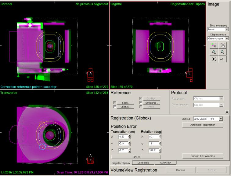 Figure 18: Screenshot of XVI 3D-kVCBCT registration window. (Green: Acquired CBCT; Purple: Pinnacle Export) 2.