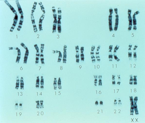 Chromosome In all human cells (except egg and sperm cells) there are 23 pairs of chromosomes The 23 pairs comprise 22 pairs of numbered chromosomes (1-22) called autosomes, and one pair of sex