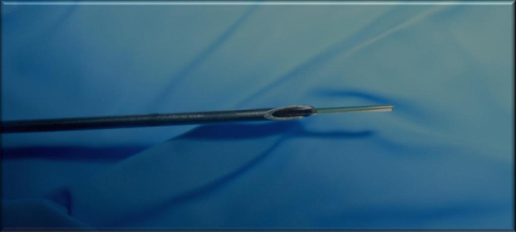 Pacella s technique : flat tip technique introducer sheath : needle 21G (0.