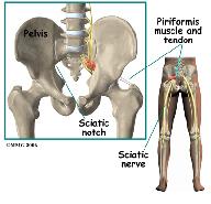 The piriformis muscle and tendon travel over the top of the sciatic nerve as the nerve leaves the pelvis at the sciatic notch.