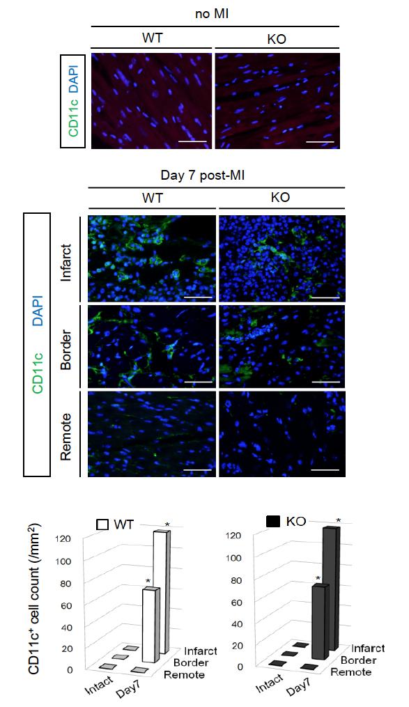 Supplemental Figure 7 Supplemental Figure 7. Post-MI spatiotemporal changes of CD11c + cells in Trib1 -/- mice were identical to those of WT littermates.