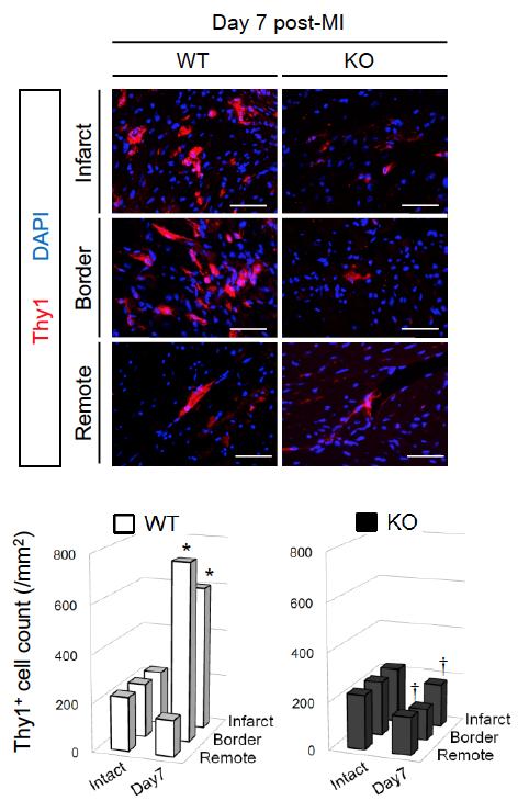 Supplemental Figure 9 Supplemental Figure 9. Post-MI activation of cardiac fibroblasts was impaired in Trib1 -/- mice.
