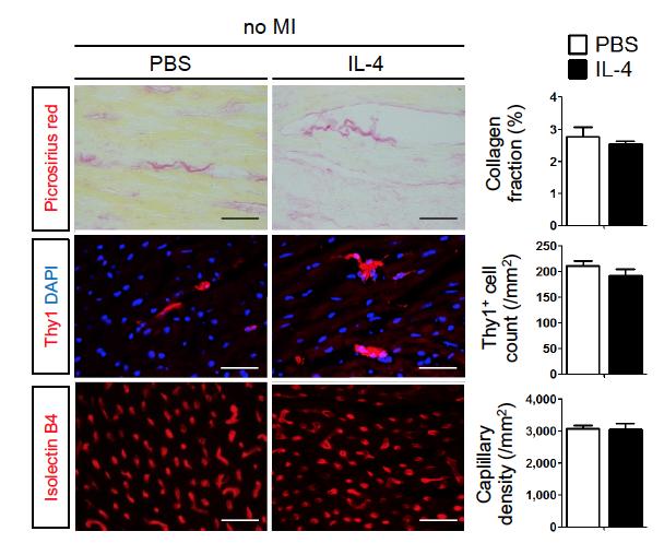 Supplemental Figure 15 Supplemental Figure 15. IL-4 treatment did not affect cardiac fibroblasts or capillary vessels in the intact (no MI) heart.
