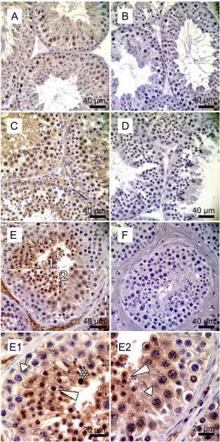 Figure S7. Immunohistochemical detection of TEX11 in normal testicular tissue sections of mouse (A-B), macaque (Macaca fascilaris) (C-D), and human (E-F).