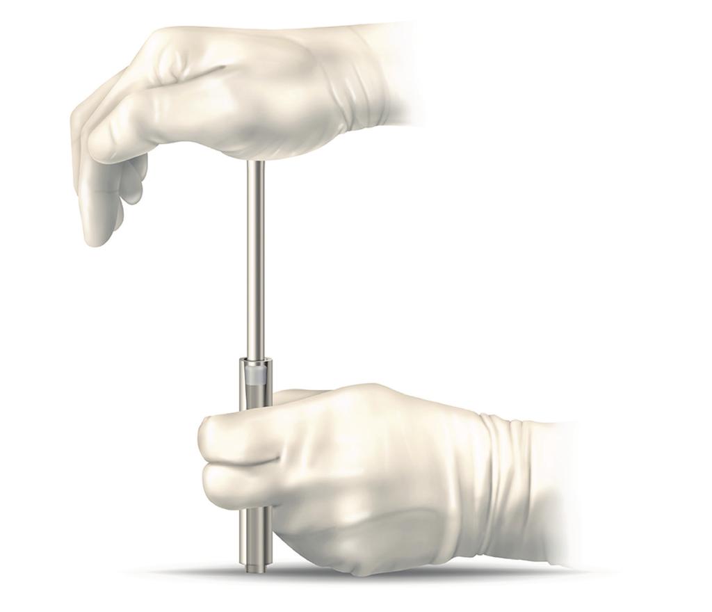 CARTIVA SYNTHETIC CARTILAGE IMPLANT PREPARING THE IMPLANT FOR INSERTION Remove the Cartiva implant from the sterile packaging using smooth forceps. Moisten Introducer tube with sterile saline.