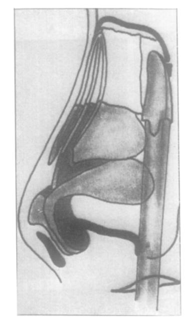 spine and the cartilaginous part is pushed forward between the two Mar cartilages so that the nasal tip remains elastic and the bony base unites with the spine. B79 I FIG 6, B FIG.