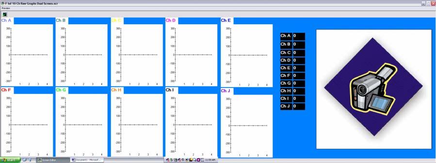 F Inf 10 Ch Raw Graphs Dual Screen.scr Channel Set: F Inf 10 Ch EMG.
