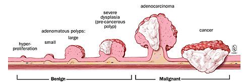 Pathogenesis Signs and