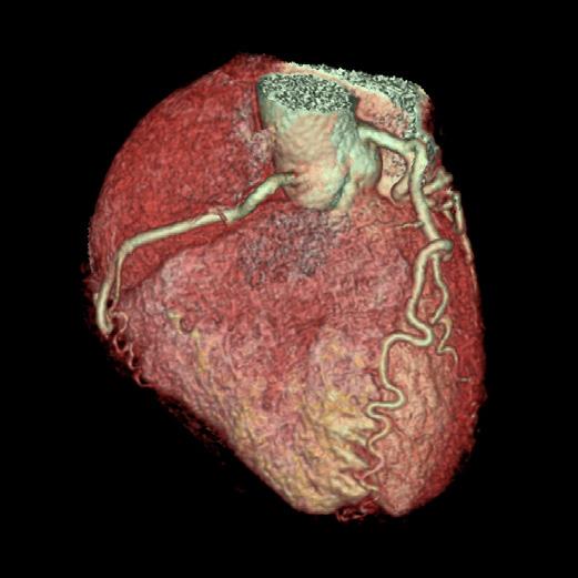 Cardiac Imaging with Revolution