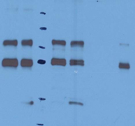 The blot on panel A was probed with SA-HRP antibody and the blot on panel B was probed with factor Va-heavy chain and light chain antibodies.