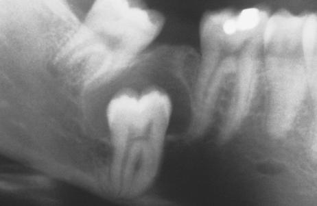 Same clinical and radiographic features can be seen with other