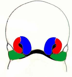 SUMMARY OF CLEFT LIP, CLEFT PALATE CLEFT LIP Medial Nasal Maxillary CLEFT PALATE 1) CLEFT LIP