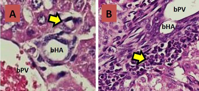 Figure 3. Histological features of liver and biliary tissues of mice on day 14. A. Control group.no infiltration of inflammatoy cells nor narrowing of the lumen of bile duct (yellow arrow); B.