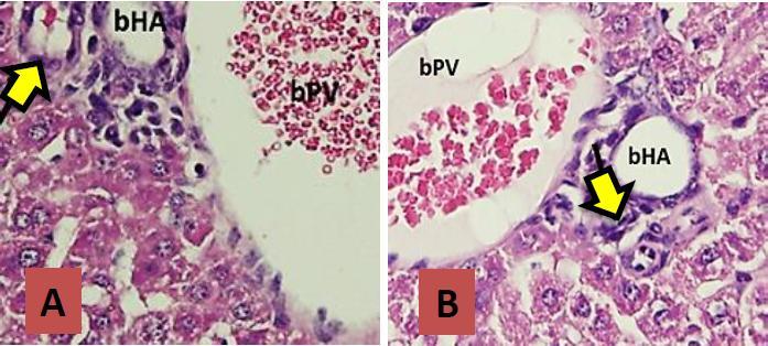 Histological features of liver and biliary tissues of mice on day 21. A. Control group: no infiltration of inflammatoy cells neither narrowing of the lumen of bile duct (yellow arrow); B.
