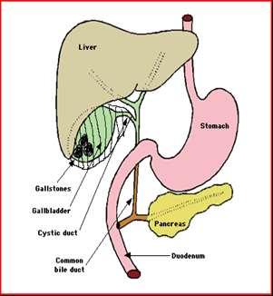 Introduction Cholecystectomy is removal of the gallbladder that is located under your liver on the right side of your upper abdomen (see picture 1) Picture 1: gallbladder (with gallstones), liver,