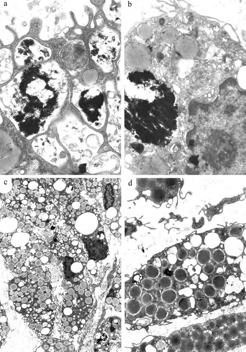 15 Figure 3 Histopathology of 2-week specimen shows phagocytosed macrophages with numerous cytoplasmic foldings (a) and the electron dense phagozomes in the