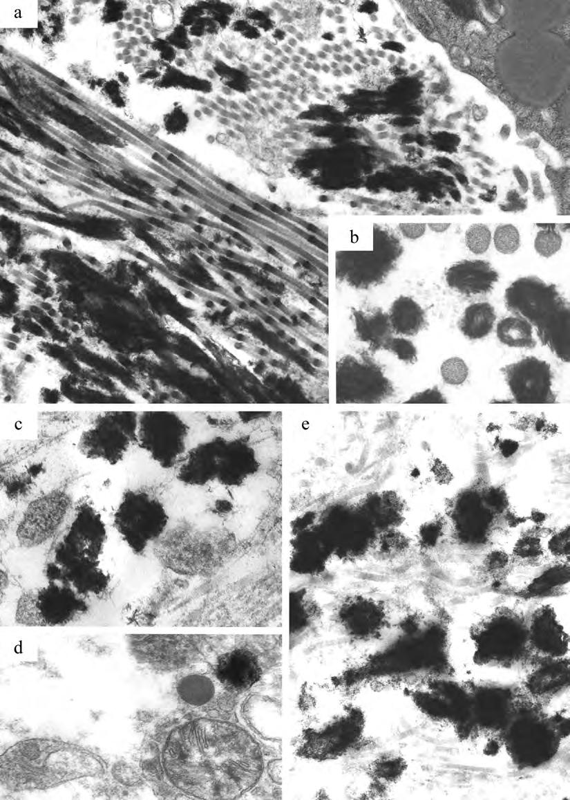 19 Figure 7 Electron dense crystals appearing on the surface of the collagen fibers (a), a cross sectional view (b), varied vesicles among in