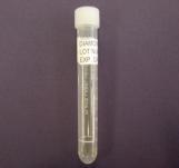Type Vaginal Wet Prep Varicella Zoster Diamonds Media M4 or M5 Media Vaginal Collect specimen using supplied swab. Swabs with wood handle are not acceptable.