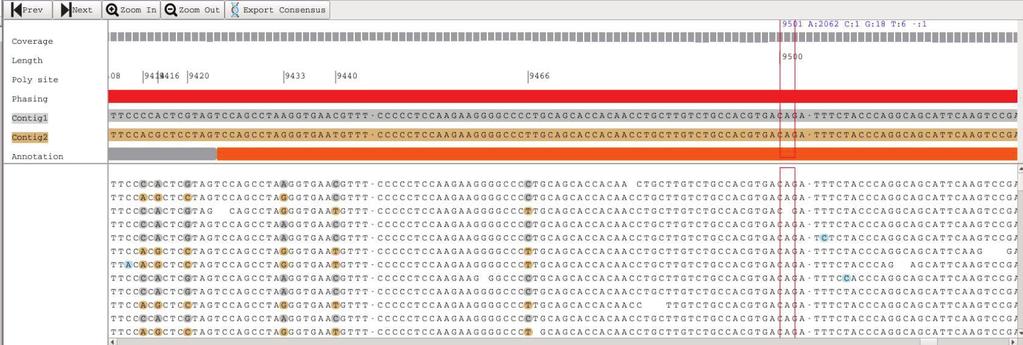 c) Contig Browser indicates the presence of only A at the position 9501 Figure 2: Novel allele with three base mismatches in exon 3 of DPA1*02:02:01 Sample AN12 has three base mismatches in exon 3 of