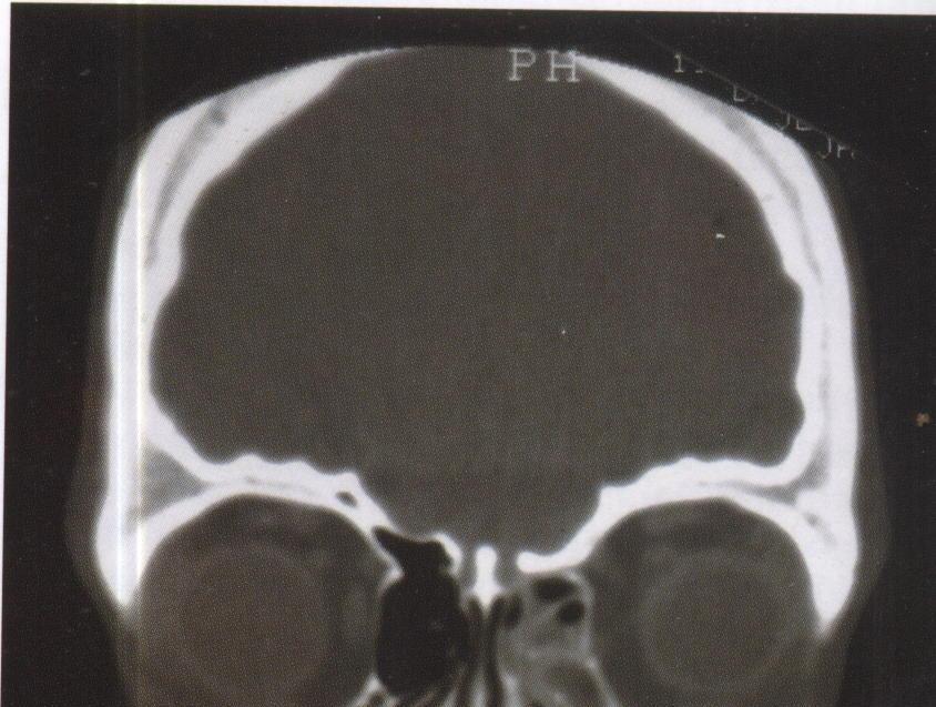 Diagnosis studies 1) Imaging CT