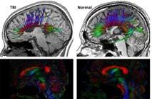 Magnetic Resonance Imaging (MRI) 37 Brain Symmetry &