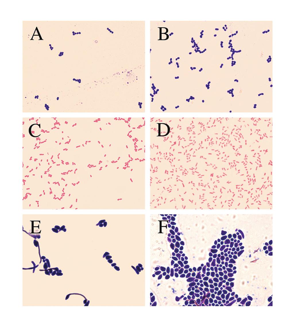 Figure 2: Gram staining of gram-positive bacteria, gram-negative bacteria and yeast.
