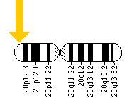 THREE TYPES OF CJD: Familial ~Inherited form ~Very rare ~Located on PRNP gene