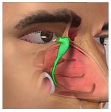 11) (Fig.11) Nasolacrimal Duct: This is a duct that conveys tears from the eyes into the nose.