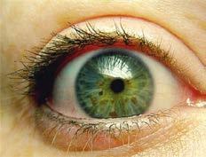 The most common symptoms of this disease are light brown skin spots also called café au laits, freckling in abnormal places, colored nodules on the eyes (lisch nodules), and benign tumors