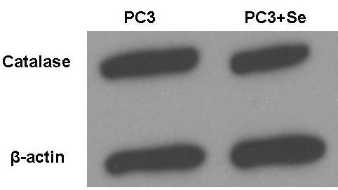 cells, but had no effect on Prdx-1, Prdx-3 or CAT.