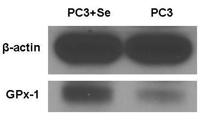 catalase, Prdx-1 and Prdx-3, were studied in PC3