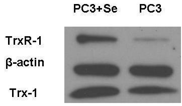 nm). A, B: Selenite did not change Prdx-1, Prdx-3