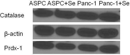 A 21 B Figure 2.6 Prdx-1 and CAT were not changed in ASPC, Panc-1, or MCF7 cells.