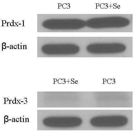 Figure 2.7 Prdx-1 and Prdx-3 were not increased by addition of selenium in PC3 cells.