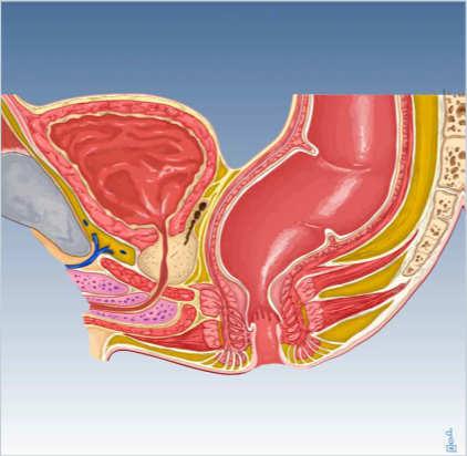 Pelvic Organ Functions: Urinary, Sexual and Bowel Dysfunction after Rectal Surgery Disclosure M ADHULIKA G.