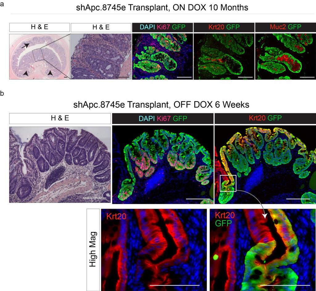 Supplementary Figure 3 Comparison of APC silenced and APC-restored tumors in the shapc.8745e transplant model. a. H&E and immunofluorescent stains of an shapc.