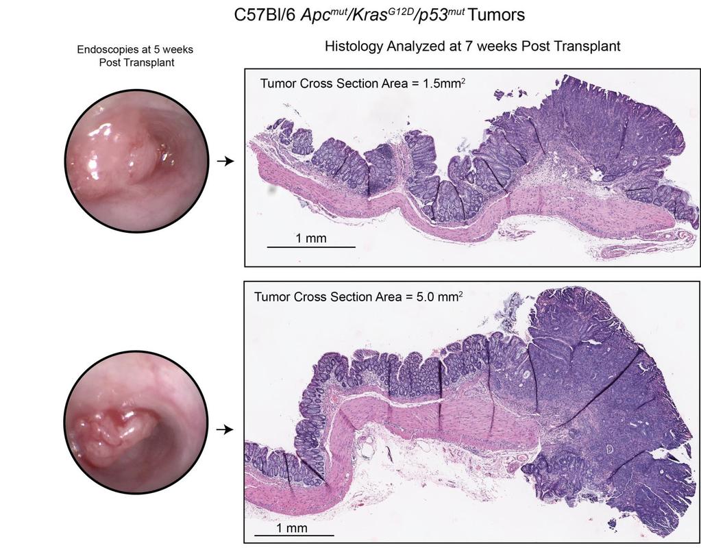 Supplementary Figure 6 Endoscopies and matched histologies of tumors harvested from the immunocompetent CRC model.