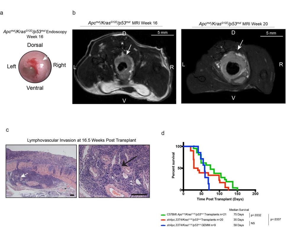 Supplementary Figure 7 Disease staging by MRI, lymphovascular invasion and survival analysis of the immunocompetent CRC model. a. Colon endoscopy (also shown in Fig.