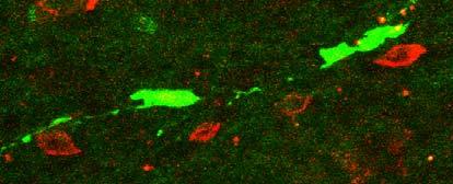 Whole TGs were excised 5 days PI, and stained for CD8α (red) and gb promoter activity is exhibited by green fluorescent protein (green).