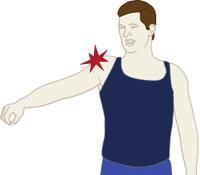 Page ( 3 ) Symptoms The most common symptoms of a rotator cuff tear include: Pain at rest and at night, particularly if lying on the affected shoulder Pain when lifting and lowering your arm or with