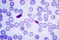 Antibodies are being studied that kill malaria parasites within the mosquito.