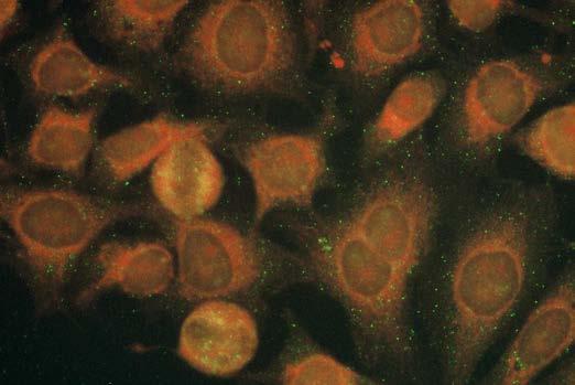 Anti-Jo-1 antibody photo 48 AF/CDC-10* Fine granular speckled cytoplasmic staining, but weak fluorescence is usual.