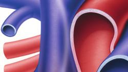 While heart attack is described as a plumbing problem, SCA is more of an electrical problem that prevents the heart from functioning effectively.
